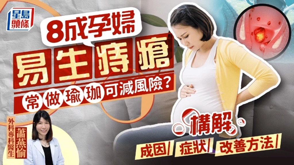 《星島頭條》報導：8成孕婦易生痔瘡 常做瑜珈可減風險 醫生解構成因症狀改善方法