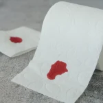 排便出血可能是有腸道腫瘤？察覺這一症狀需就醫！