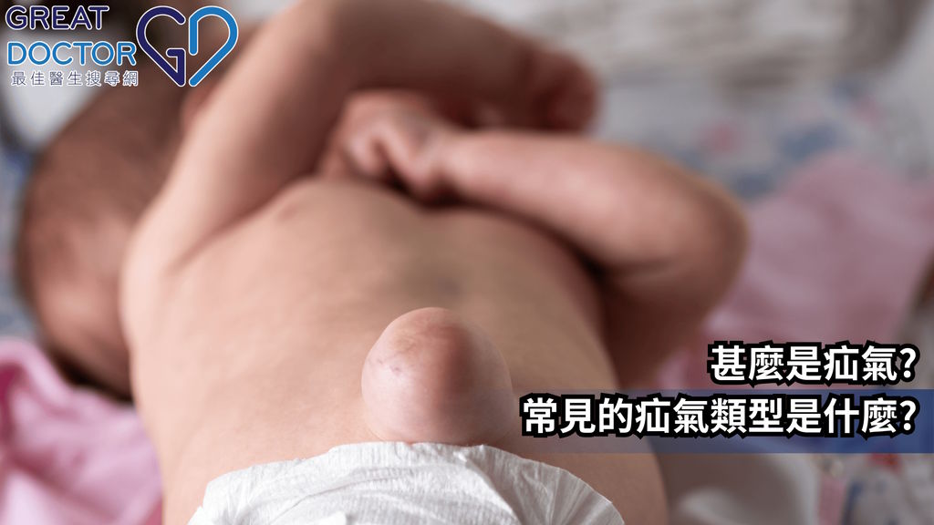 甚麼是疝氣?常見的疝氣類型是什麼?